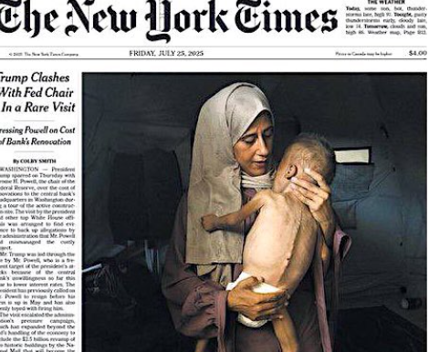 Gaza Starvation Hoax Photos: The New York Times claimed the Palestinian baby in this photo suffered from malnutrition, but failed to note that the child actually suffers from a pre-existing muscular disorder, not starvation. More than a dozen legacy media used similar fake photos. 
